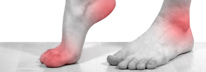 Custom Foot Orthotics in Canton MI Custom Foot Orthotics in Canton MI